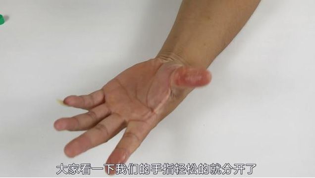 502膠水把手黏住了怎么辦